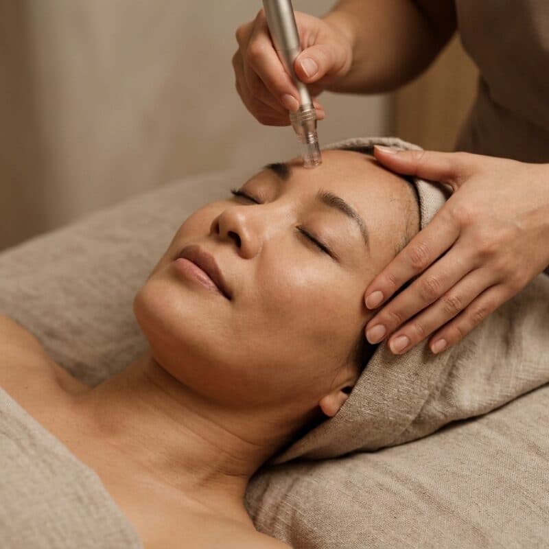 A microneedling pen held above the forehead of a woman lying back on folded linen, one hand resting at her temple.